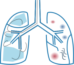 Functional lung reconstruction