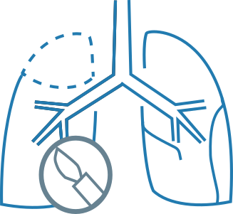 Pre-operative evaluation