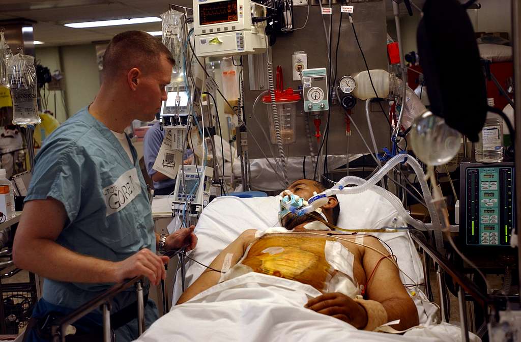 Mechanical Ventilation Optimization in the ICU
